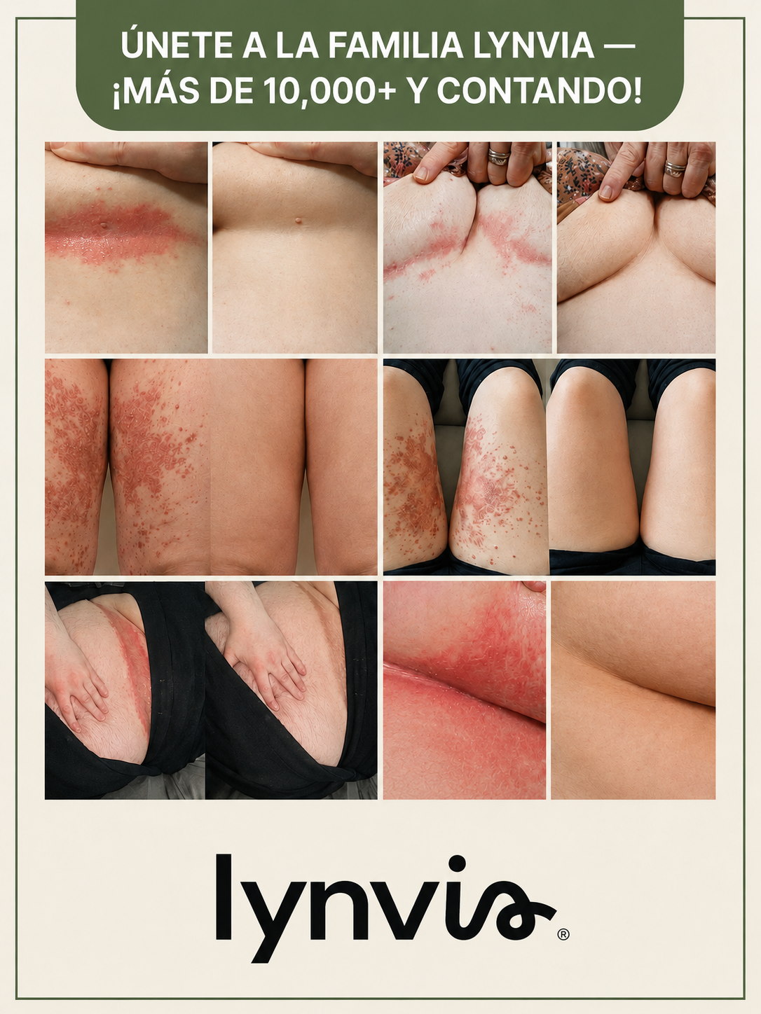 LYNVIA ANTI-FRICCIÓN® Crema Protectora para la Piel 230 ml