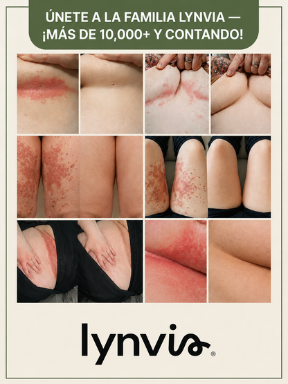 LYNVIA ANTI-FRICCIÓN® Crema Protectora para la Piel 230 ml